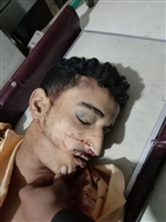قصة شقيقين في تعز أعتقل الحوثيون أحدهما وأغرقوا الآخر بدمائه أمام أعين والدته 