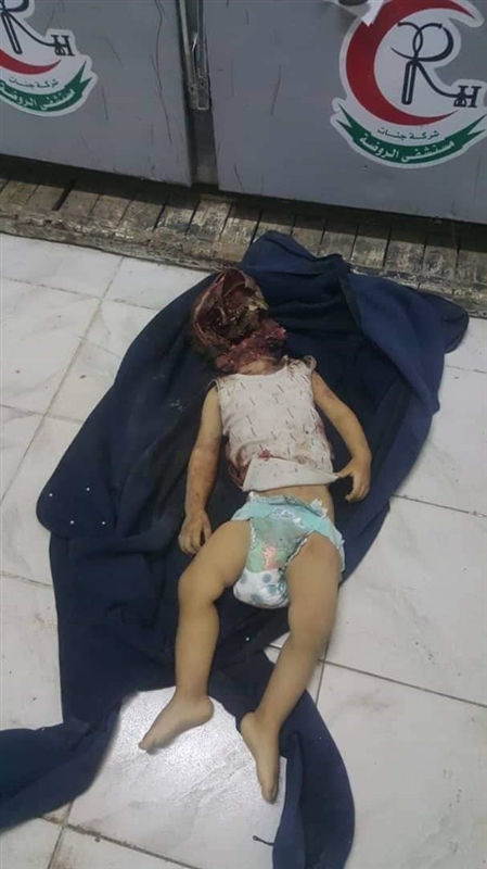 مقتل طفلين وإصابة أخرين في قصف حوثي جديد على تعز