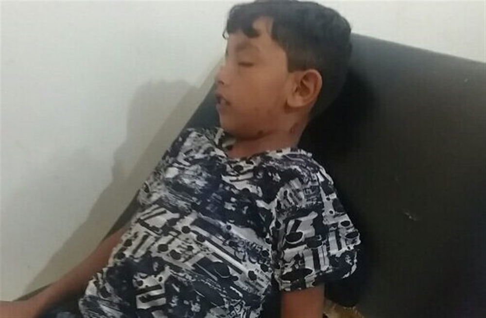 الضالع: إصابة 5 أطفال بينهم امرأة في قصف حوثي شمال مريس