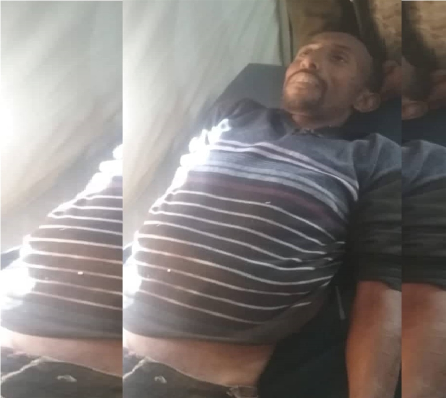 وفاة صومالي متأثرا بجراحه في حادث غامص جنوبي تعز
