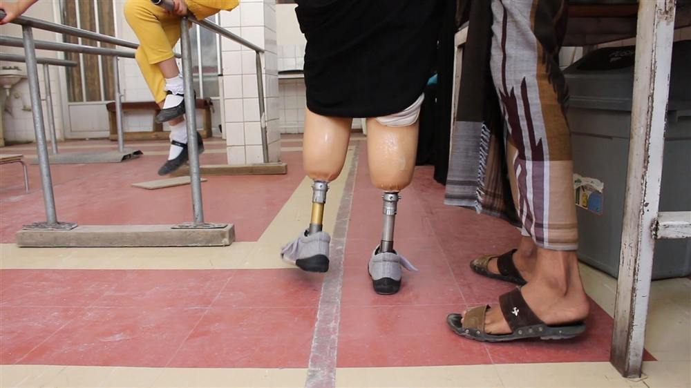 الأطراف الاصطناعية: قصة من قلب مأساة الحرب في اليمن