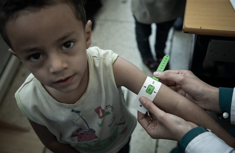 الأغذية العالمي: اليمن يسجل أعلى مستويات سوء التغذية بين الأطفال في العالم