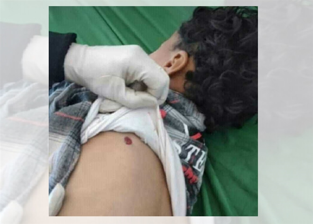 مقتل طفلين برصاص راجع في إب