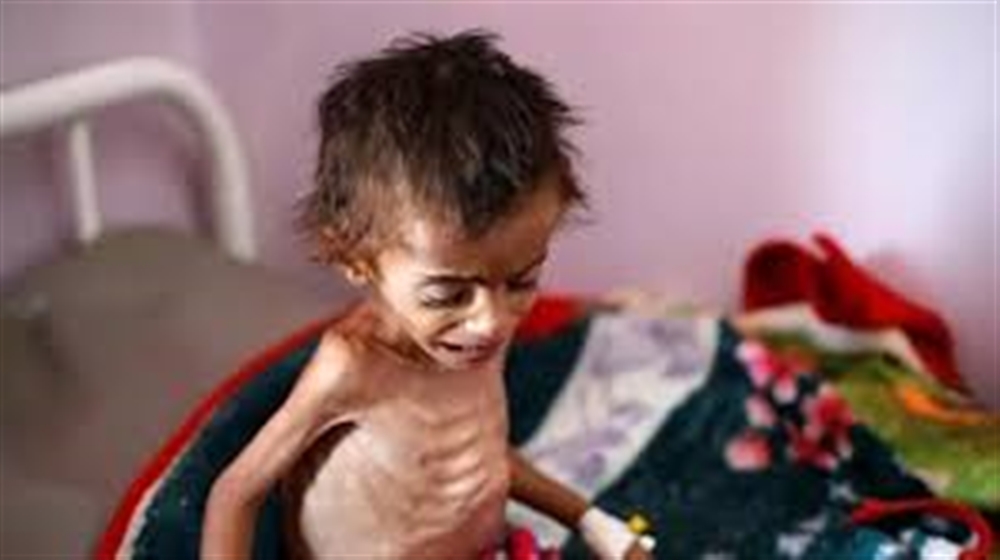 منظمة اممية  : 10 مليون شخص قريبون من المجاعة والنظام الصحي على وشك الانهيار