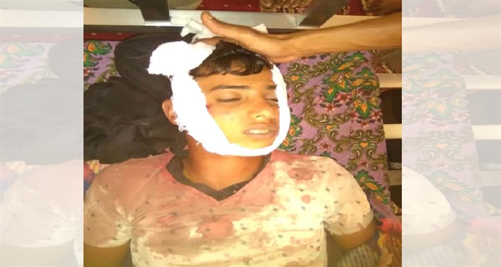 منظمة: قنص الحوثيين للأطفال أسلوب ممنهج يستوجب تحرك "اليونسيف"