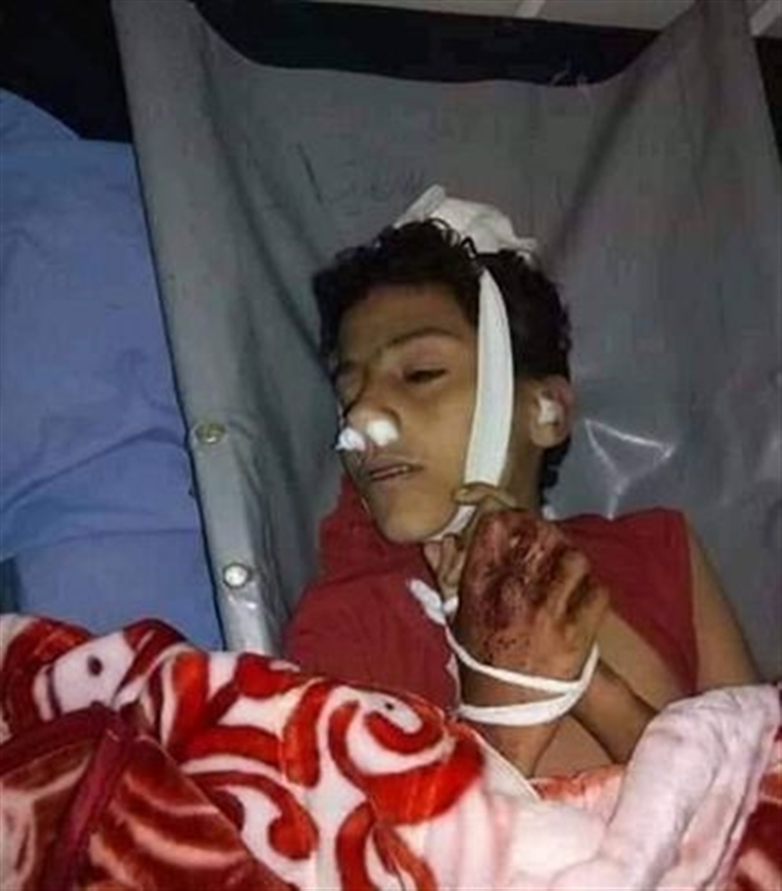 مليشيا الحوثي تقتل طفلا  في الحيمة شمالي تعز