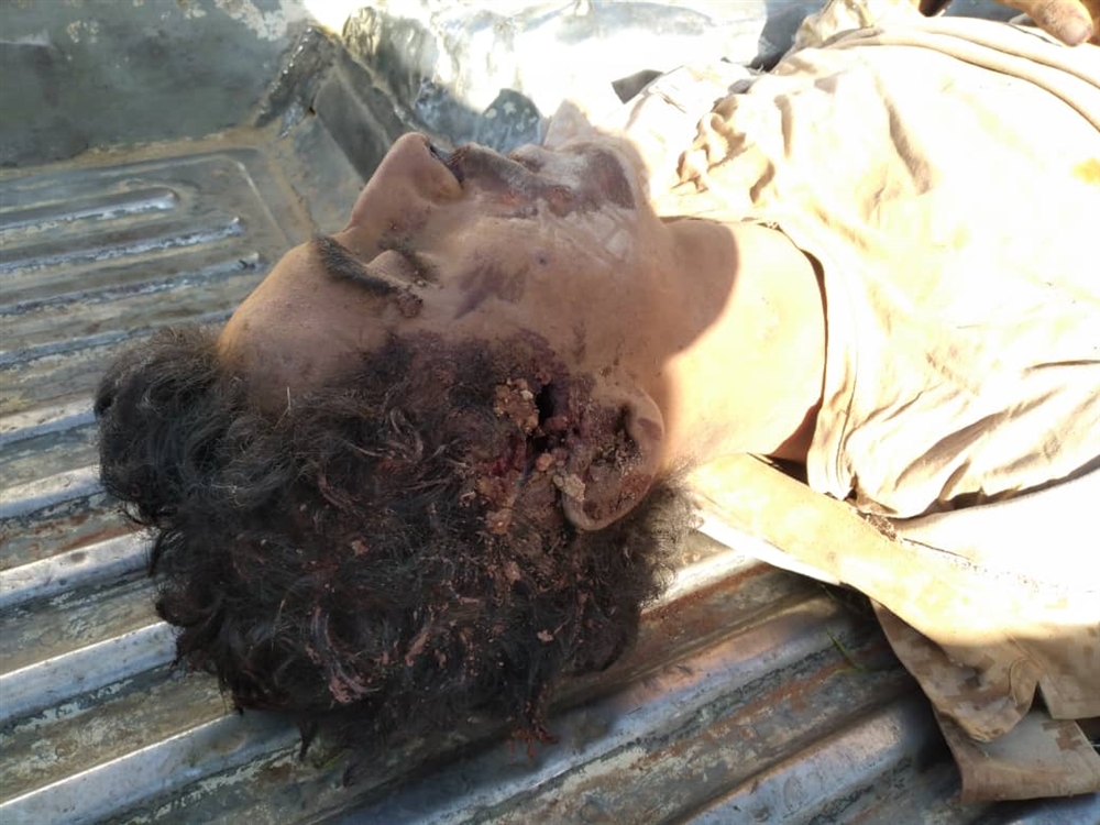 مقتل قائد الحوثيين في جبهة هيلان ومستشفى عبدالقادر المتوكل تقر بعجزها عن استقبال جثثهم