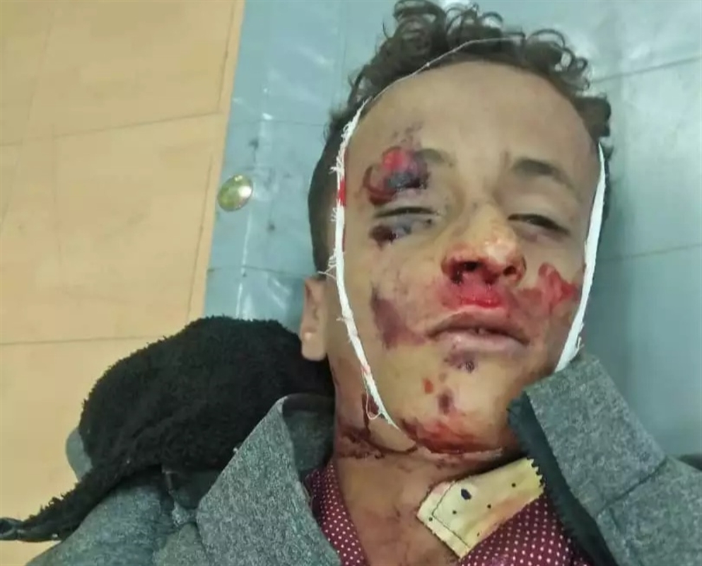 مصادر محلية : وفاة طفل بحادث "دهس سيارة" في لحج