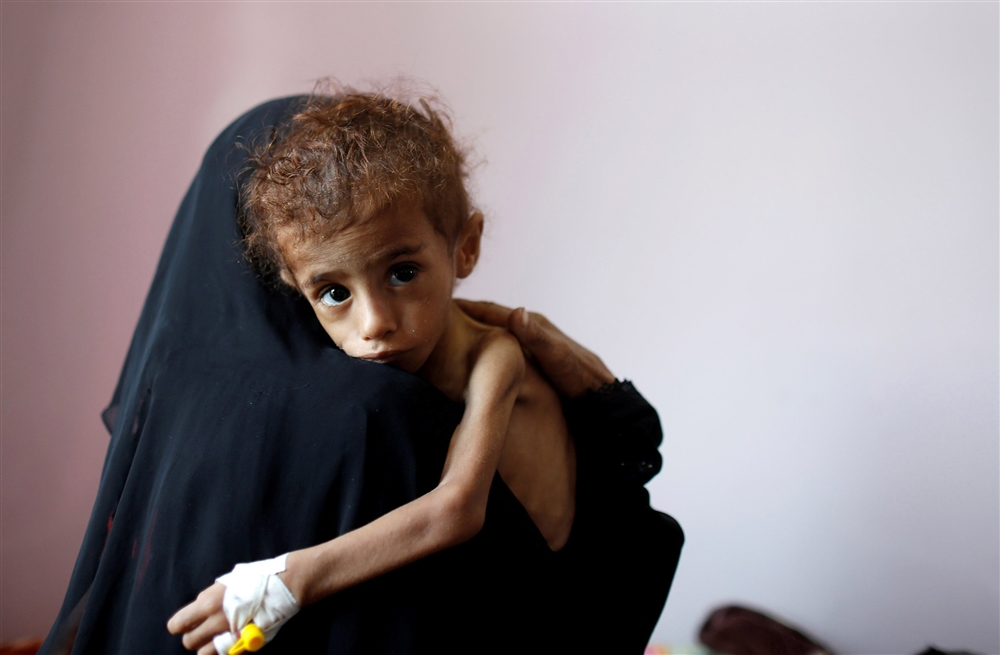 تقرير أممي: 16 مليون يمني يعانون من الجوع