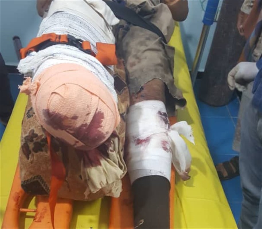 إصابة عامل في مسام لنزع الألغام بتعز