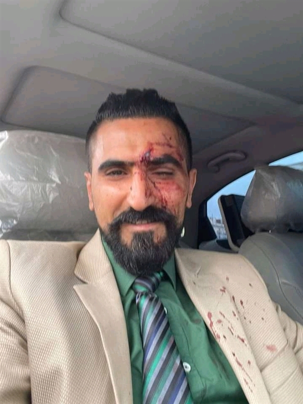 أنباء عن اعتداء يطال محامي الأغبري في محكمة بصنعاء