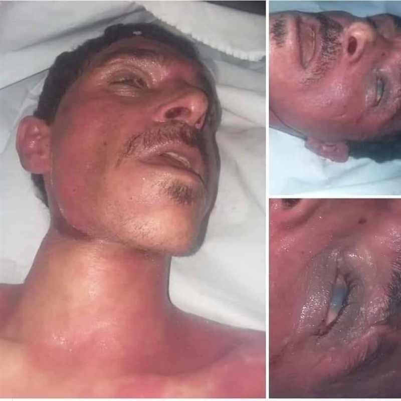 الحوثيون يجبرون أسرة مواطن توفي تحت التعذيب على التنازل عن القضية
