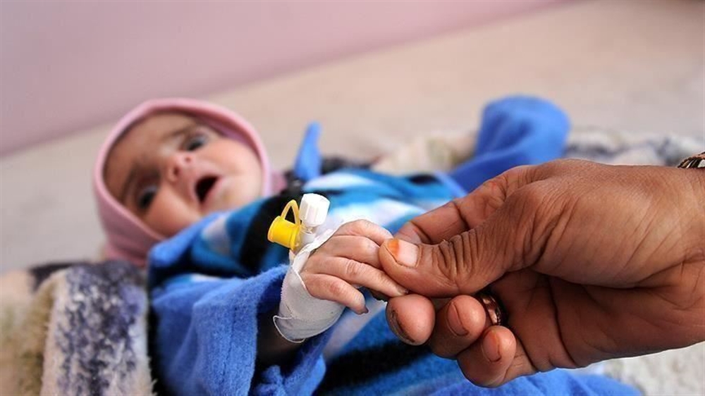 الصحة العالمية: ثلاثة أرباع أطفال اليمن يعانون سوء التغذية