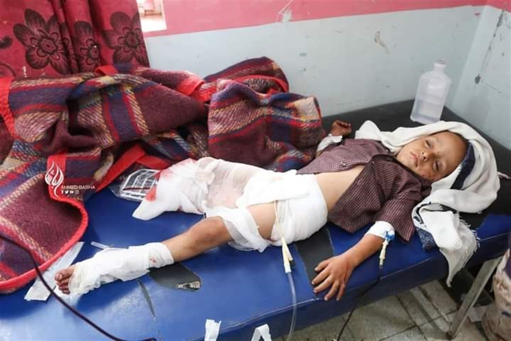 لجنة حكومية توثق مقتل وجرح 2764 طفلا في اليمن