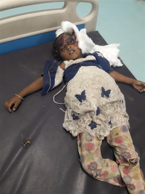 بطيران مسير.. مليشيا الحوثي تقتل طفلة وتصيب أهلها أثناء نزوحها من مقبنة إلى حيس
