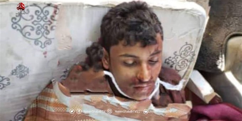 مسلحون حوثيون يعدمون شابا مدنيا في حاجز تفتيش بالبيضاء