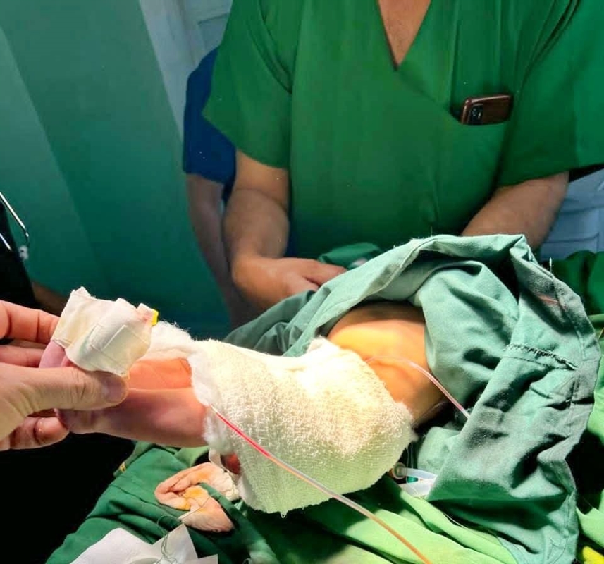 تعز.. نجاح أول عملية جراحية لإصلاح انقلاب المثانة وترميم البطن لمولود حديث الولادة