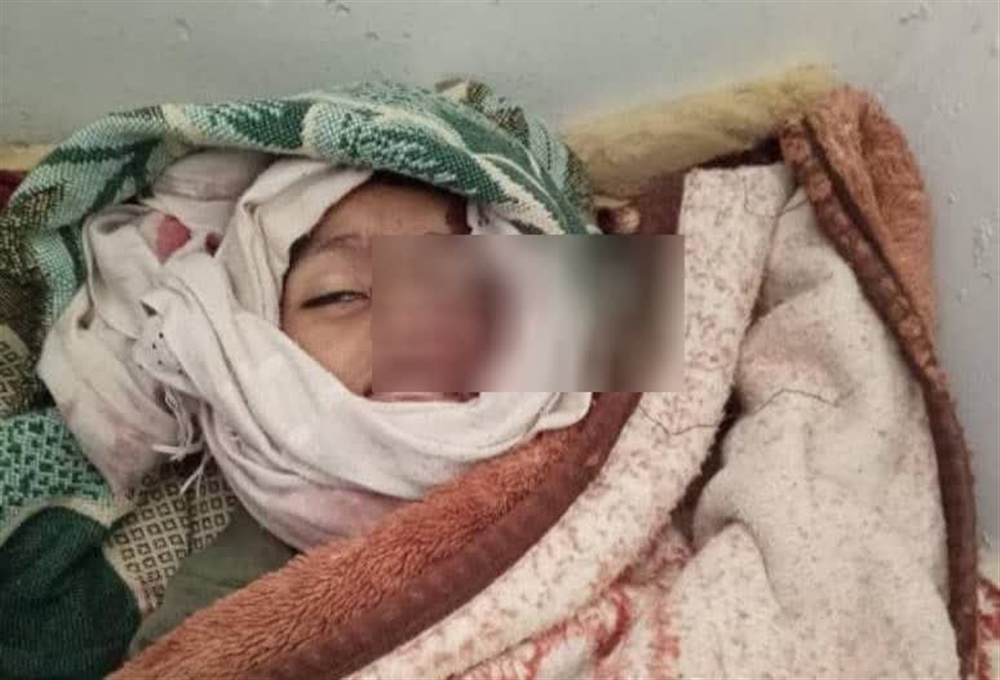 تعز.. وفاة طفل دهسا أثناء محاولته الحصول على 5 لترات من الماء