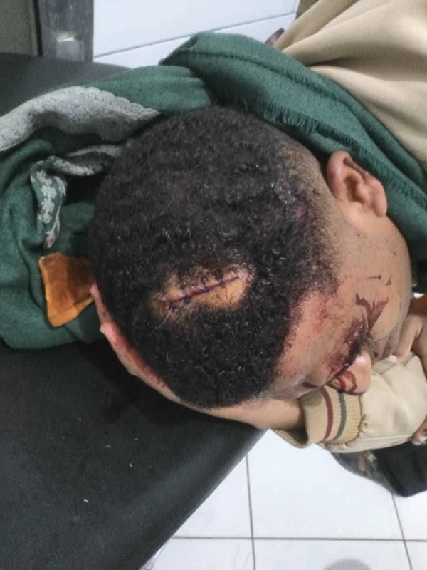 نقابة الصحفيين تدين الاعتداء على مراسل قناة سهيل في تعز