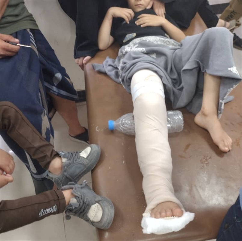 تعز.. إصابة شاب وطفل برصاص قناص حوثي في حي كلابة