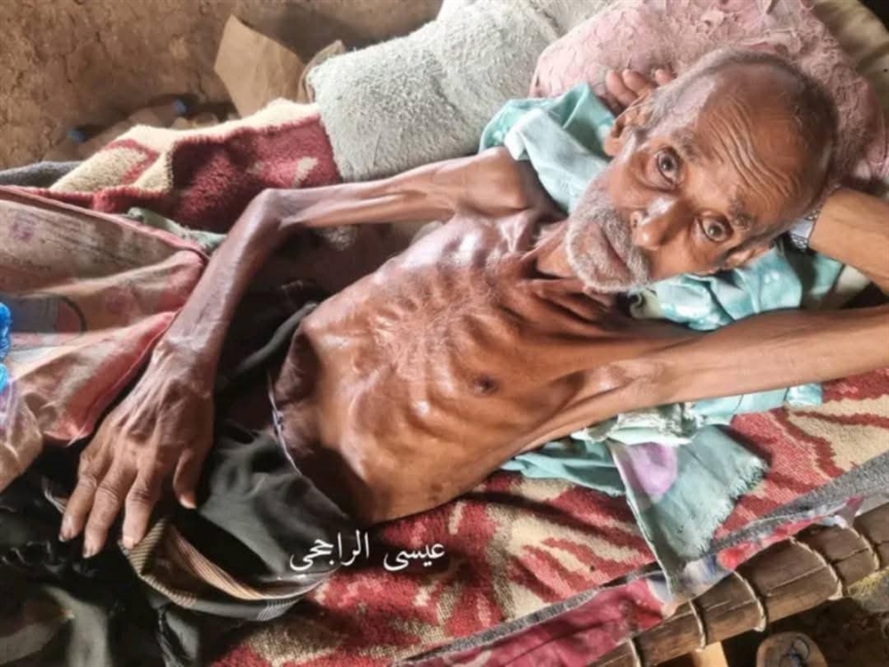 وفاة نازح مسن جوعًا في أحد مخيمات حجة