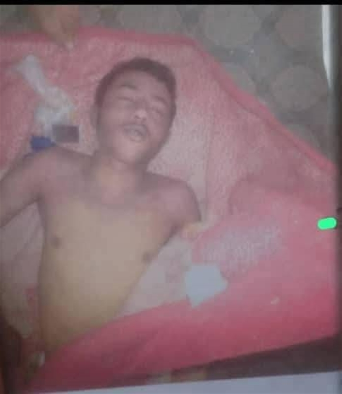 وفاة شاب تحت التعذيب في سجون الحوثيين بعمران