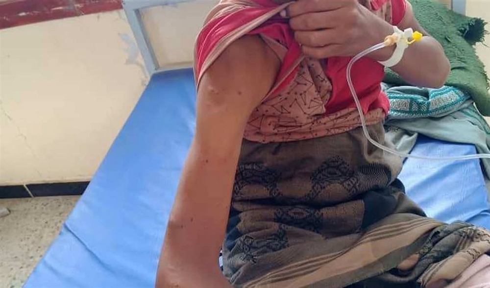 لحج.. قنّاص حوثي يستهدف طفلًا أثناء رعيه للأغنام في القبيطة