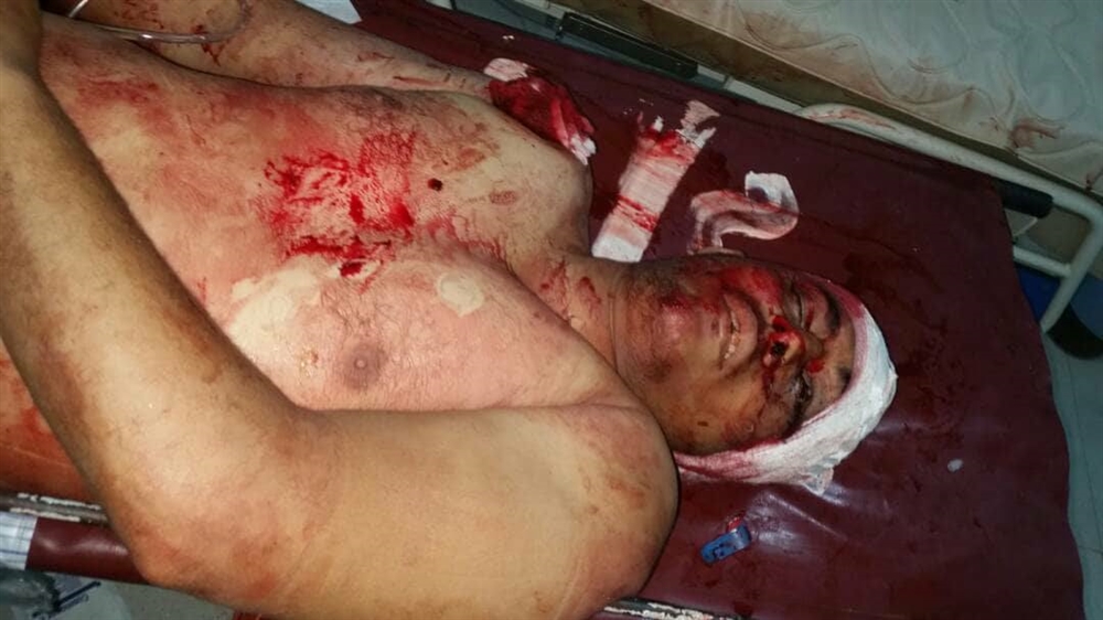 مقتل طالب حقوقي برصاص مسلحين مجهولين بتعز