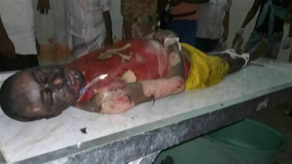 بعد ثلاث سنوات من الاحتجاز.. سجين في مركزي عدن ينتحر حرقاً