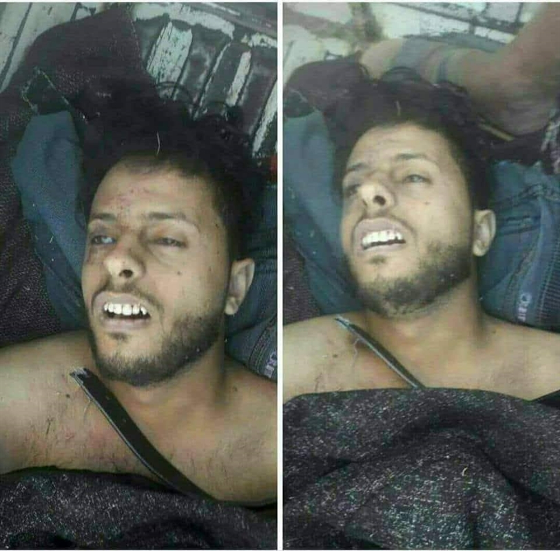 مليشيا الحوثي تقتل سائق باص في مدينة إب بسبب صورة لـ"صالح"