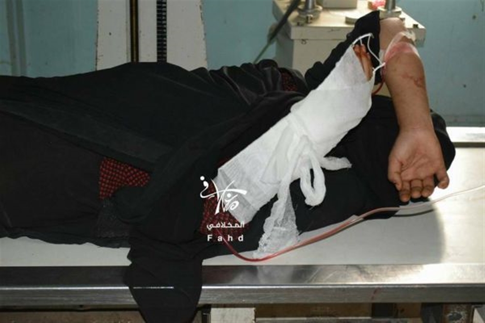 إصابة خمسة مدنيين بقصف الحوثيين منزل سكني غرب تعز