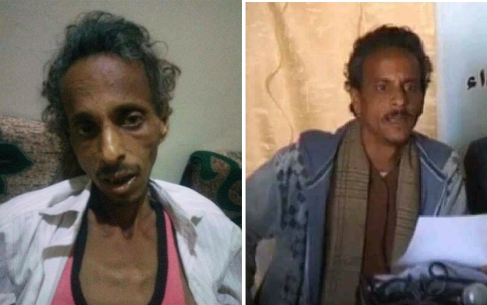 مصدر مقرب من الصحفي"الركن" يكشف أساليب التعذيب التي تعرض لها في سجون الحوثي حتى الموت