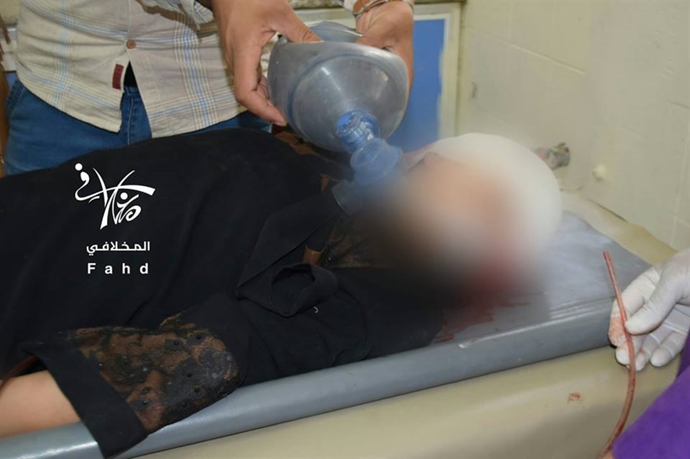 إصابة ثلاثه بينهم طفلين برصاص قناصة الحوثيين غربي تعز