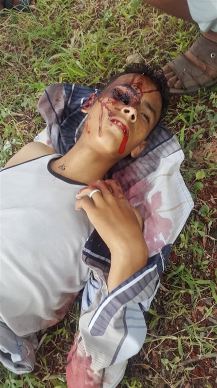مقتل طفل برصاص قناص حوثي في مقاطرة لحج
