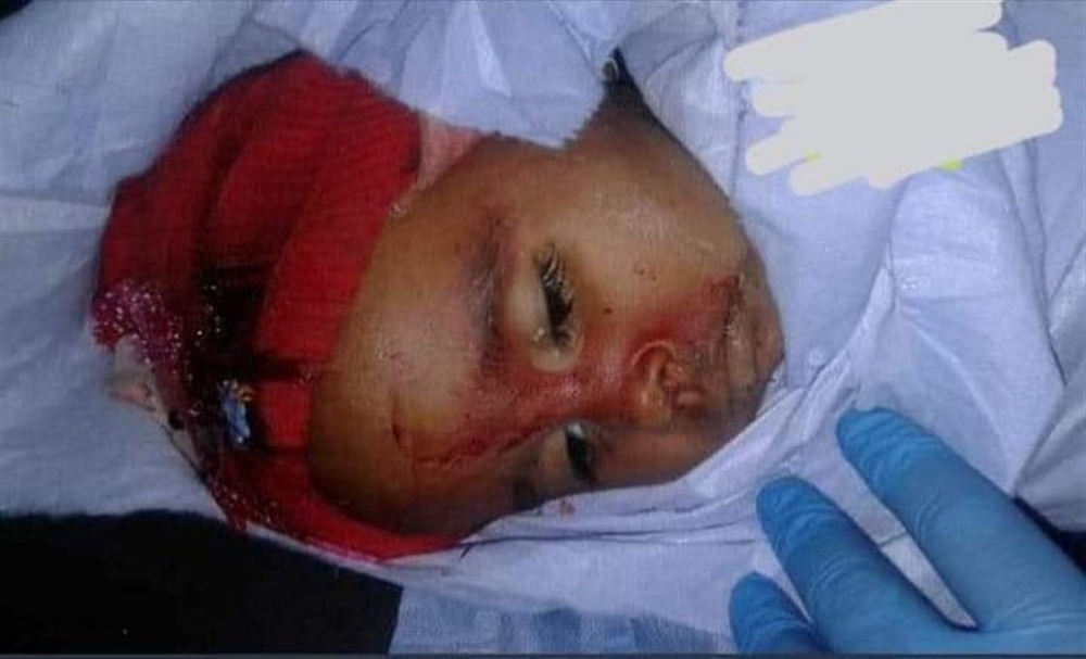 اليونسيف ترفض الإشارة إلى مسؤولية الحوثي في مجزرتين قتلتا11طفلا