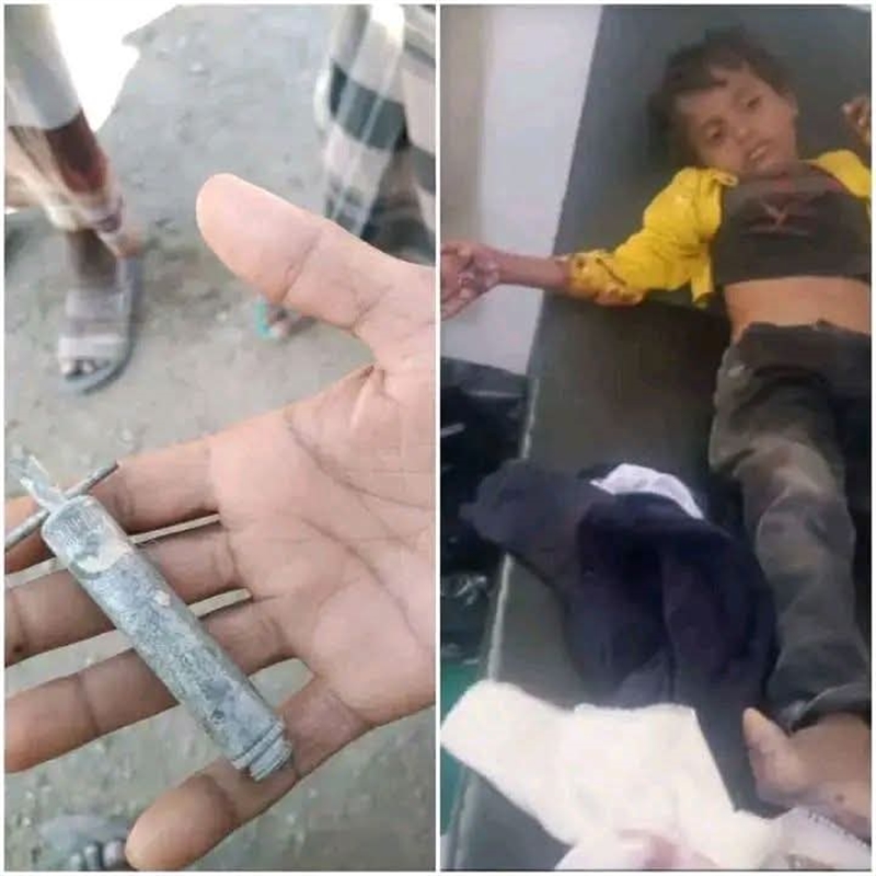 تعز.. إصابة طفل بانفجار صاعق من مخلفات الحرب في الوازعية