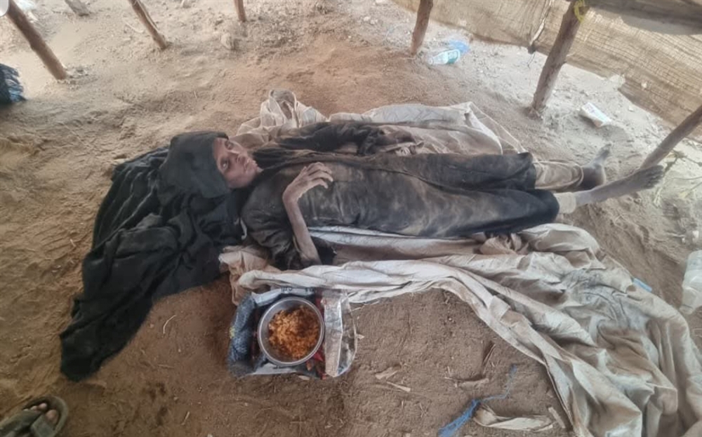 حجة.. وفاة مسنة نازحة جوعا بعد أسابيع من وفاة زوجها