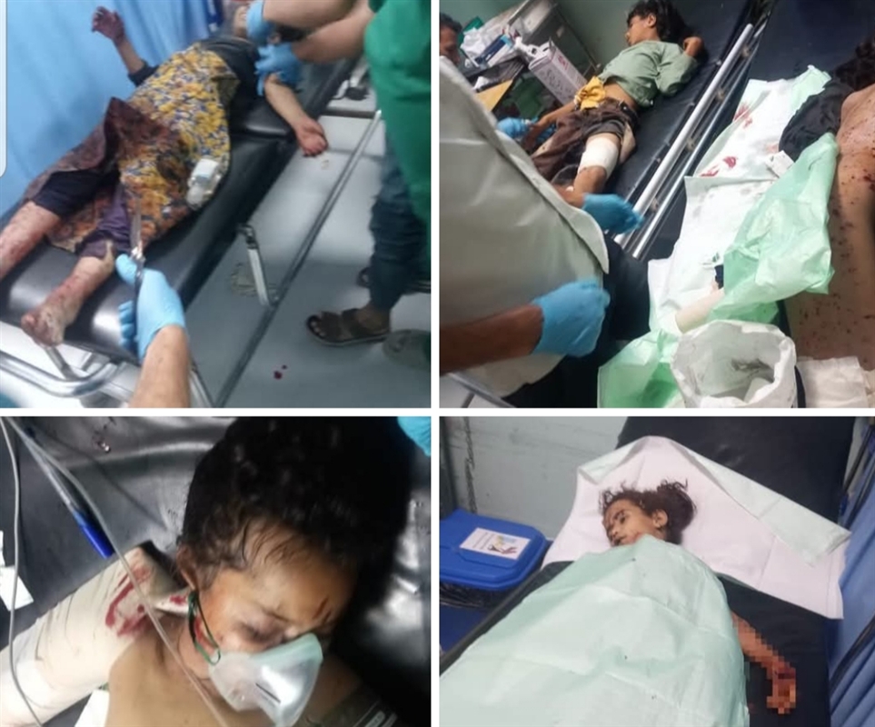 13 طفلا بين قتيل وجريح.. محافظ الضالع يوجه بتقديم الرعاية العاجلة لضحايا انفجار جسم حربي