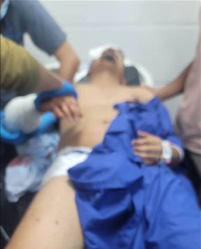 عدن.. إصابة بائع أسماك برصاص عناصر الأمن الوطني في المنصورة