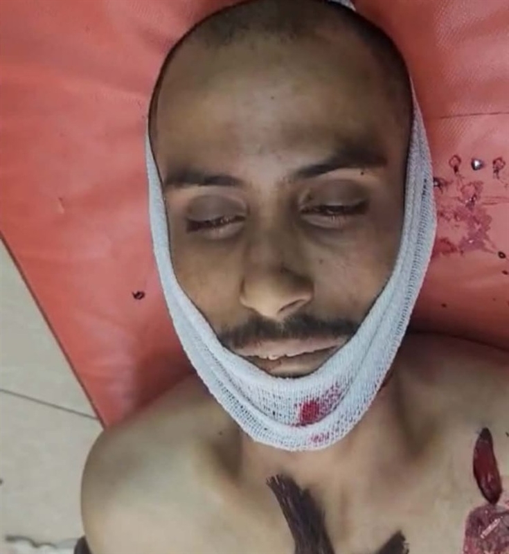 وصفوه بـ" الشهيد المغدور " ..علي عبدالله صالح تقتله إمرأته انتقاماً لنفسها