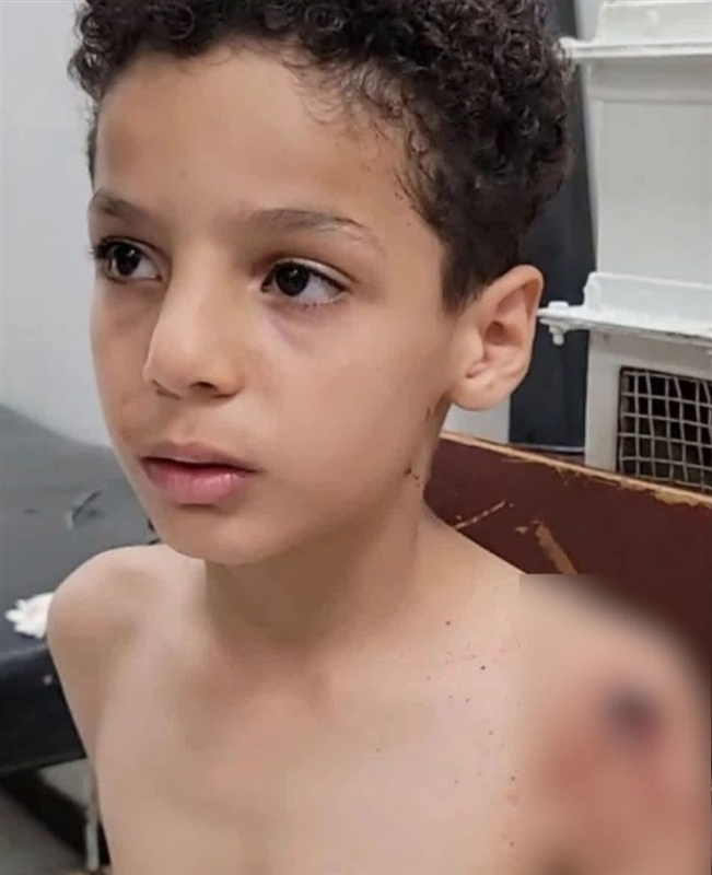 إصابة طفل بقصف حوثي استهدف حيًا سكنيًا في تعز