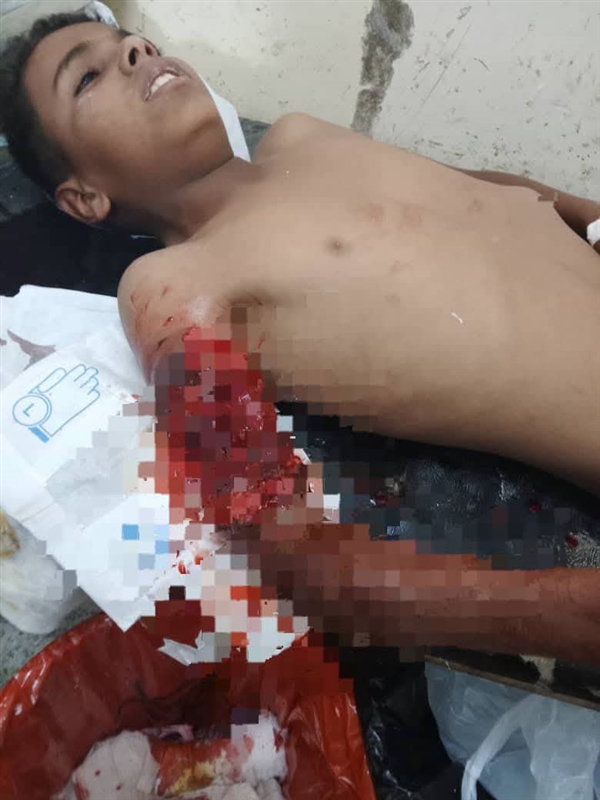 إصابة طفل وشقيقته بانفجار عبوة ناسفة زرعتها مليشيا الحوثي جنوبي تعز